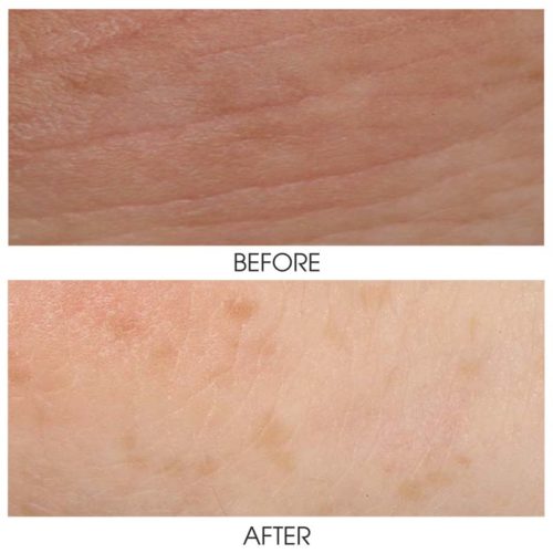 ZO Hydrating Crème Lébo Aesthetics & Spa